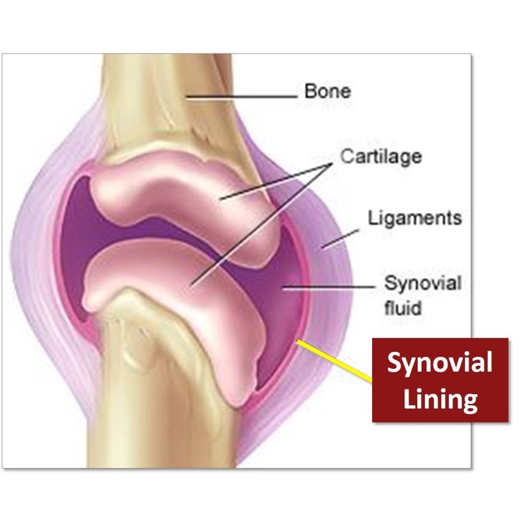Synoviocyte