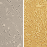 Human Coronary Artery Smooth Muscle Cells: Asthma: HCASMC-AS