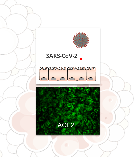 NEW! AIRWAY CELLS