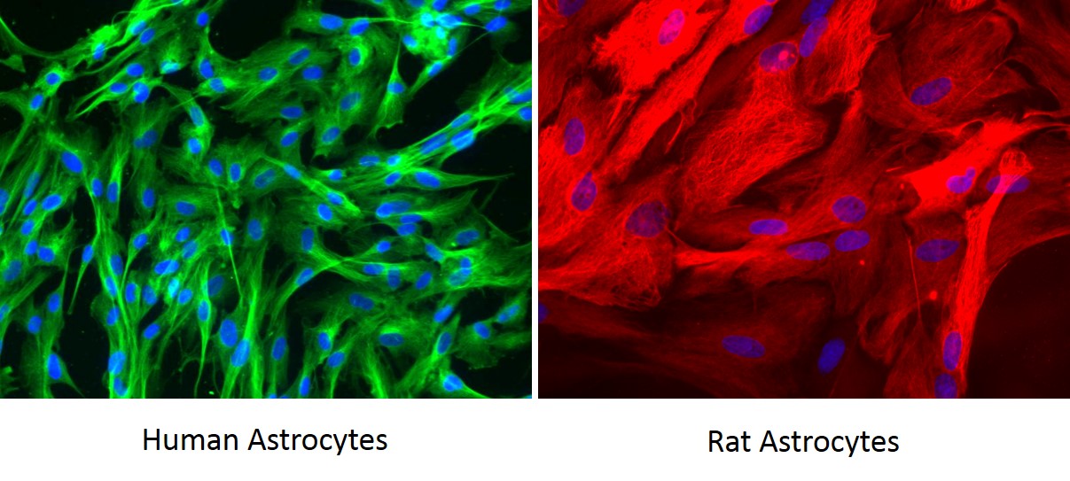 Astrocyte