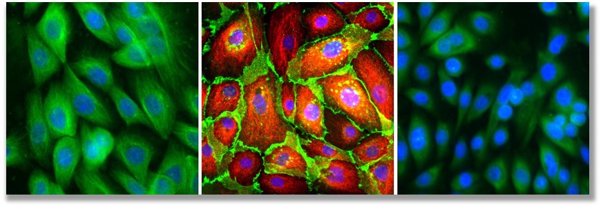 Epithelial