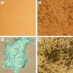 Human Mesenchymal Stem Cells from Dedifferentiated Fat: HMSC-DFAT