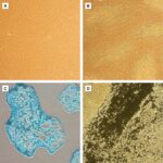 Human Mesenchymal Stem Cells from Placenta: HMSC-PL