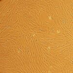 Human Mesenchymal Stem Cells from Umbilical Cord: HMSC-UC