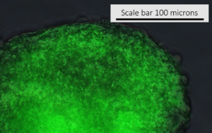 CFDA-3D zoom: Biliary ducts visible throughout a 3D i-HH organoid